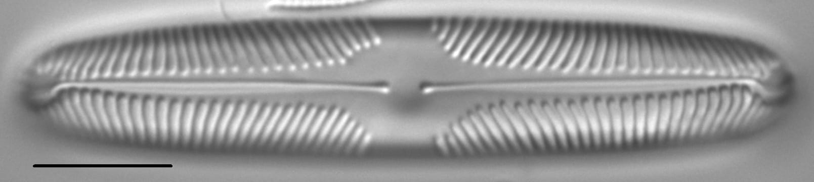 Pinnularia brebissonii LM7