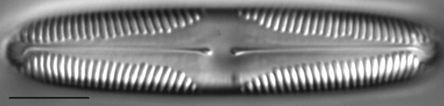 Pinnularia brebissonii LM6