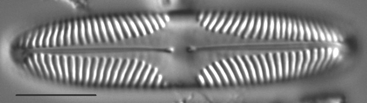 Pinnularia brebissonii LM5