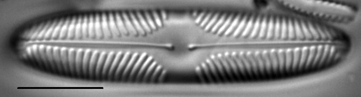 Pinnularia brebissonii LM4