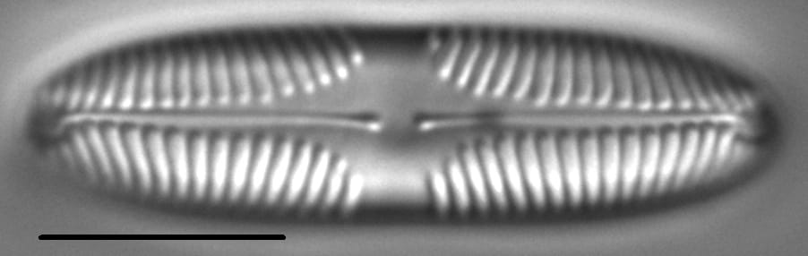 Pinnularia brebissonii LM3