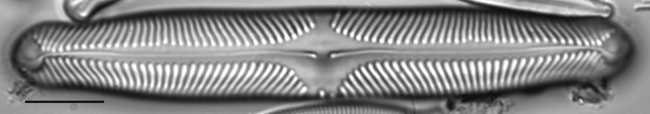 Pinnularia microstauron LM7