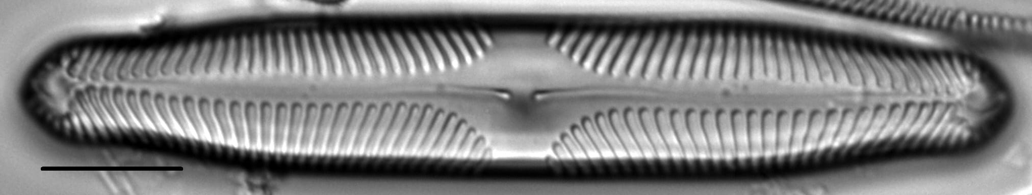 Pinnularia microstauron LM6