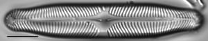 Pinnularia microstauron LM3