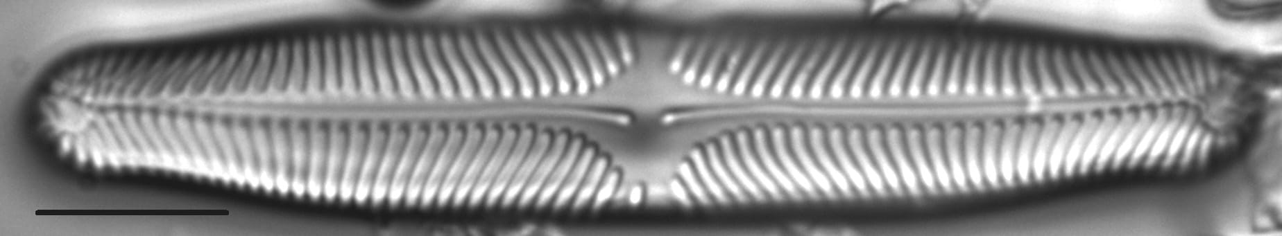 Pinnularia microstauron LM2