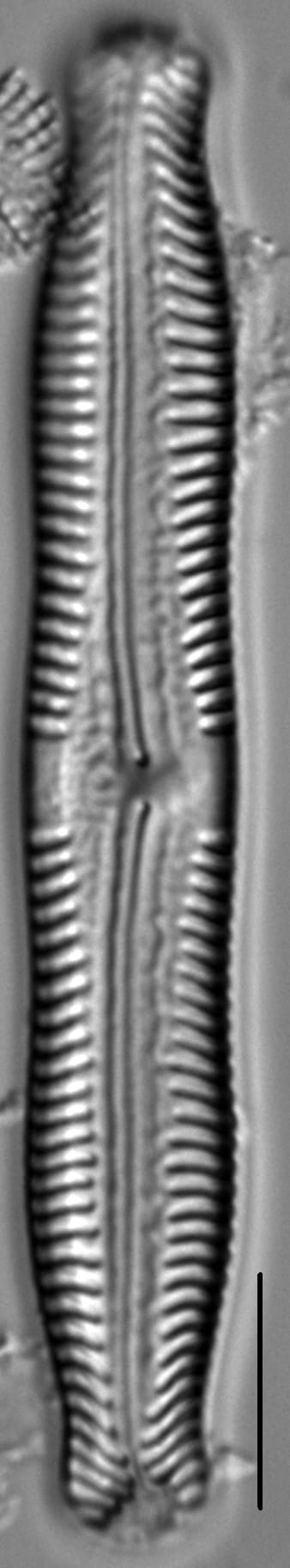 Pinnularia nodosa LM7