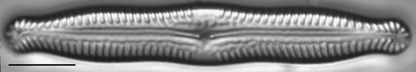 Pinnularia nodosa LM6