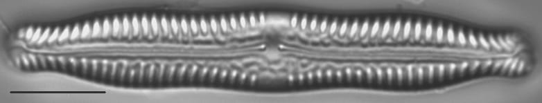 Pinnularia nodosa LM5