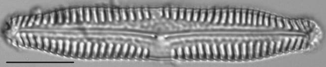 Pinnularia nodosa LM4