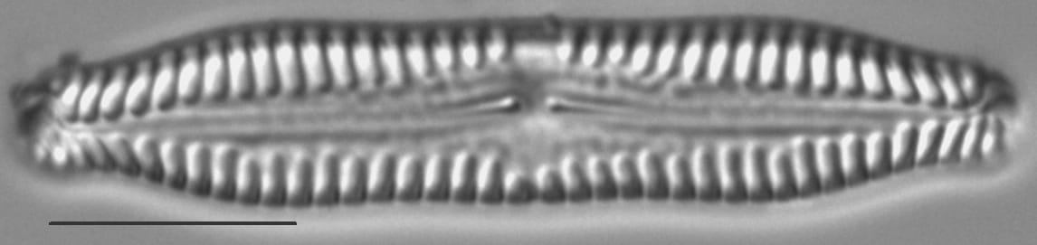 Pinnularia nodosa LM3