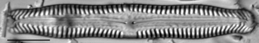 Pinnularia nodosa LM2