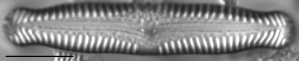 Pinnularia nodosa LM1