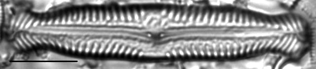 Pinnularia nodosa var percapitata LM2