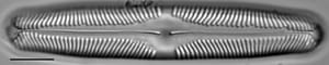 Pinnularia rhombarea LM7