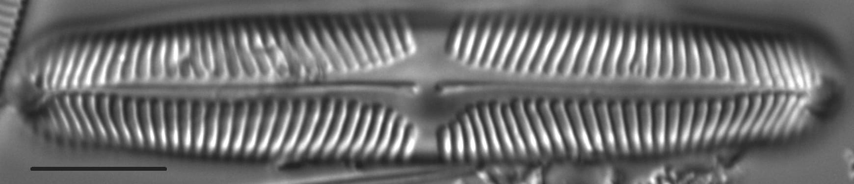 Pinnularia rhombarea LM5