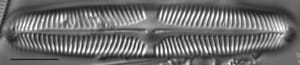Pinnularia rhombarea LM5