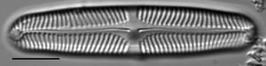 Pinnularia rhombarea LM3