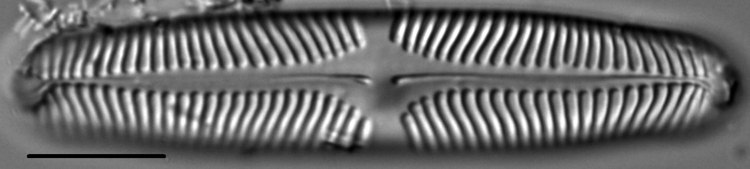 Pinnularia rhombarea LM2