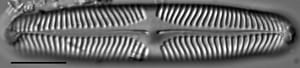 Pinnularia rhombarea LM2
