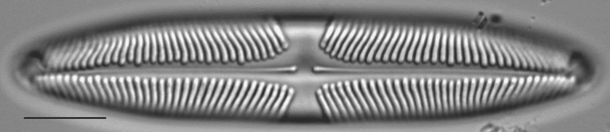 Pinnularia suchlandtii LM2