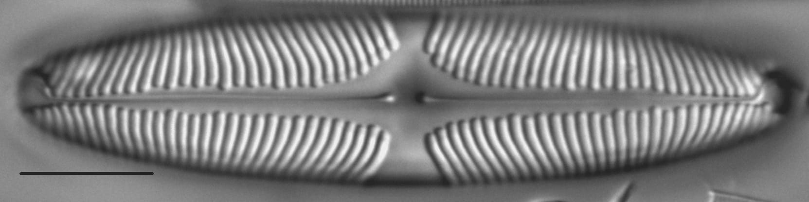 Pinnularia suchlandtii LM5