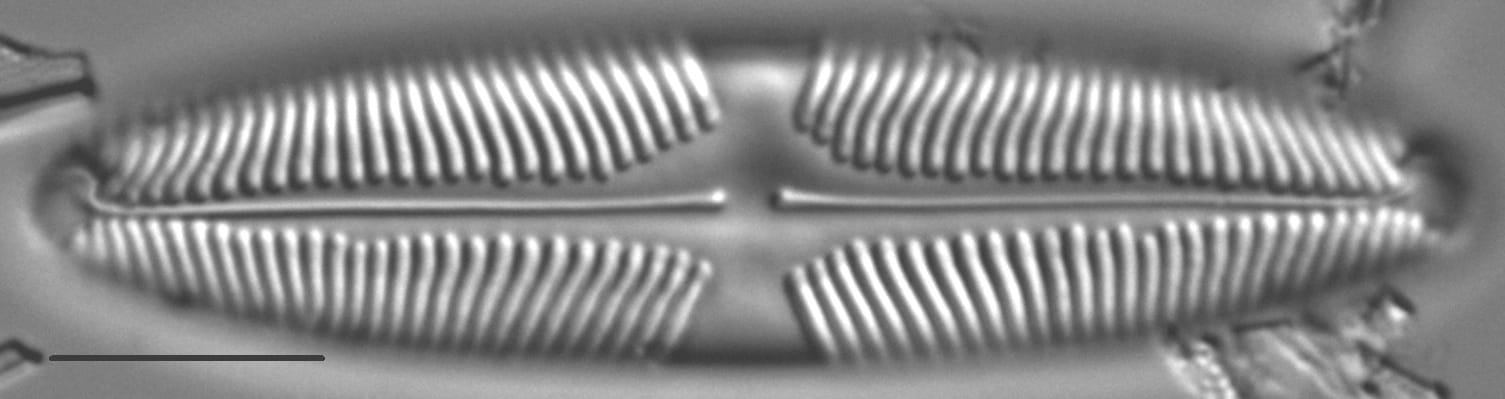 Pinnularia suchlandtii LM6