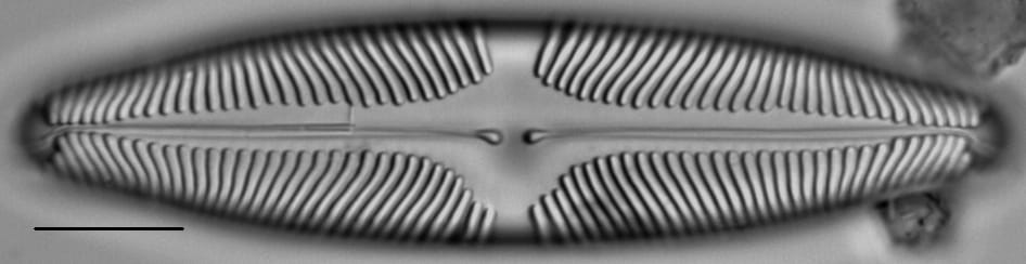 Pinnularia suchlandtii LM7