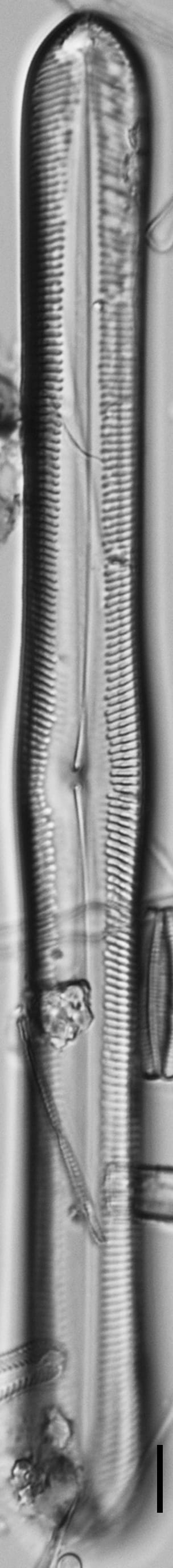 Pinnularis transversa LM7