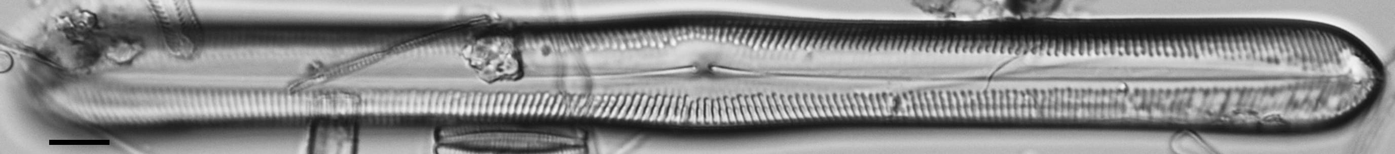 Pinnularis transversa LM7