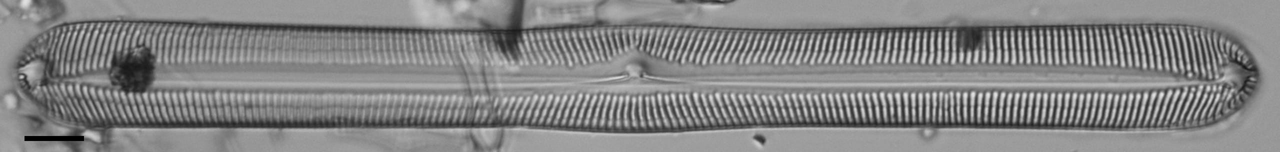 Pinnularis transversa LM1