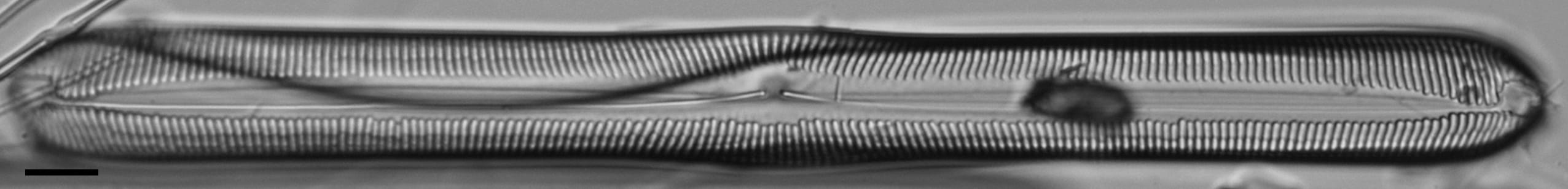 Pinnularis transversa LM6