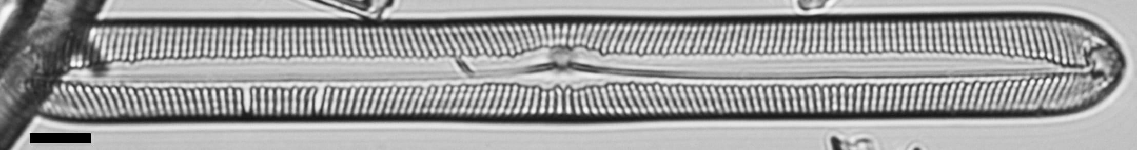 Pinnularis transversa LM4