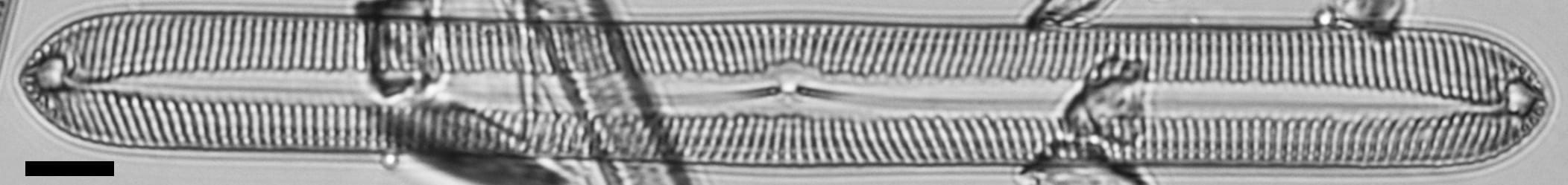 Pinnularis transversa LM3