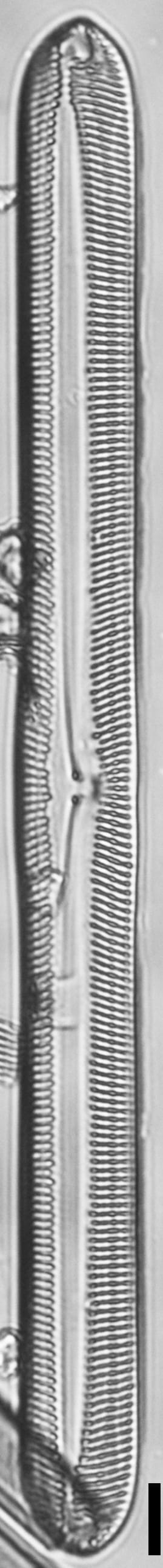 Pinnularis transversa LM2