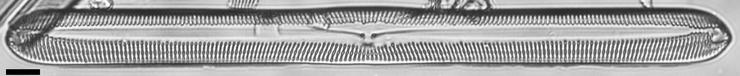 Pinnularis transversa LM2