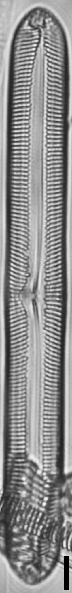 Pinnularis transversa LM5