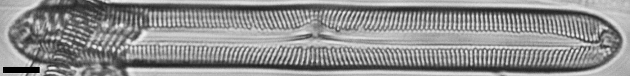 Pinnularis transversa LM5
