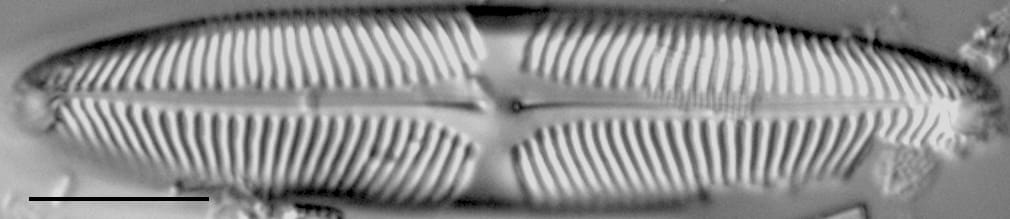 Pinularia wisconsinensis LM1