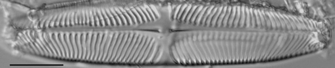 Pinularia wisconsinensis LM5