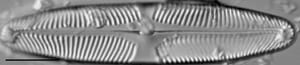 Pinularia wisconsinensis LM7