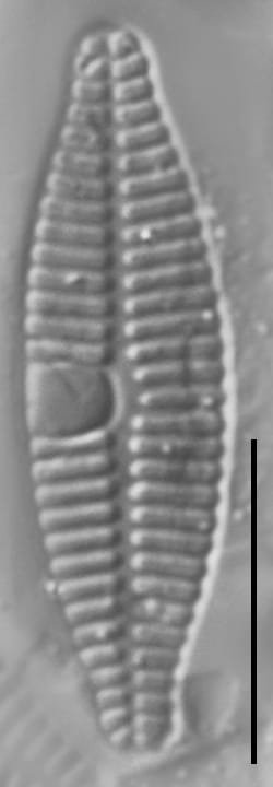 Planothidium Incuriatum LM2