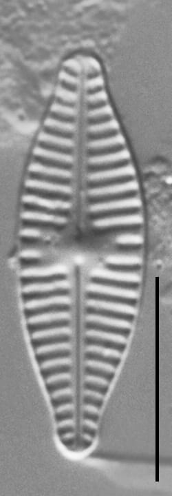 Planothidium Incuriatum Gc110451A 6A