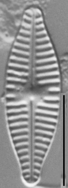 Planothidium Incuriatum Lm6