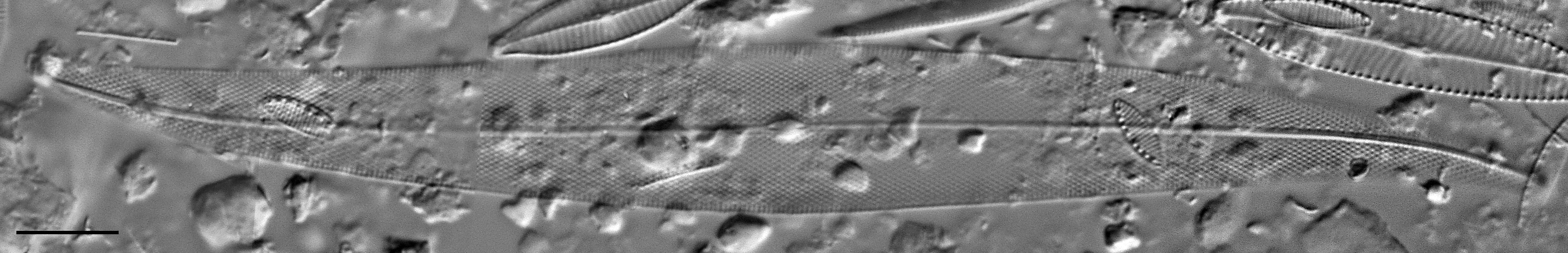 Pleurosigma Delicatulum Lm2