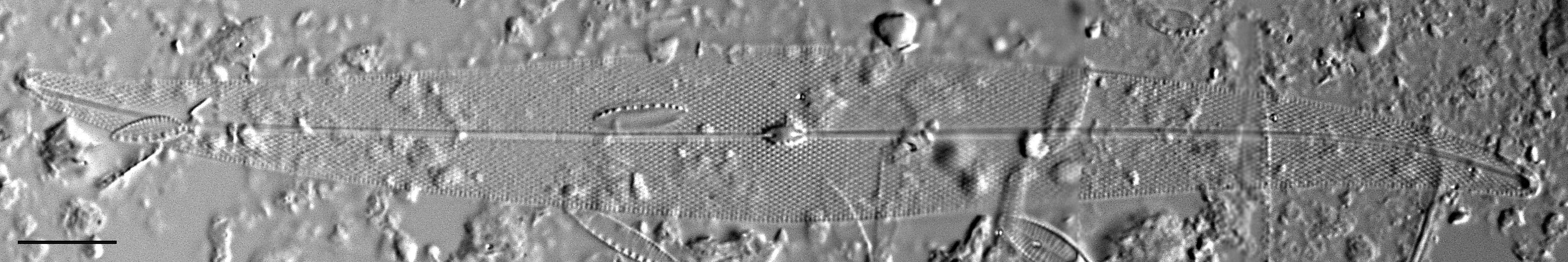 Pleurosigma Delicatulum Lm3