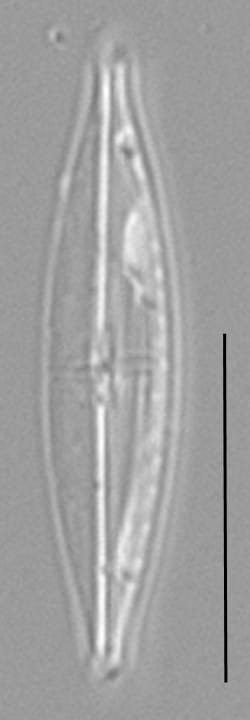 Proschkinia Browderiana Lm1