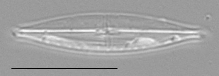 Proschkinia Browderiana Lm1