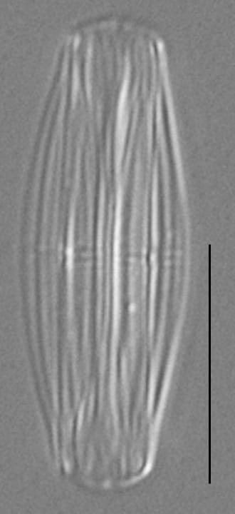 Proschkinia Browderiana Lm2