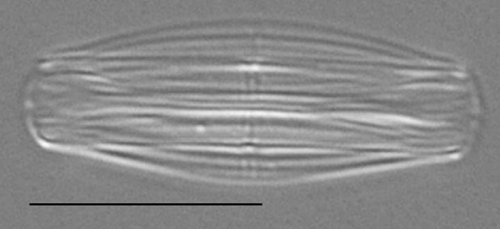 Proschkinia Browderiana Lm2