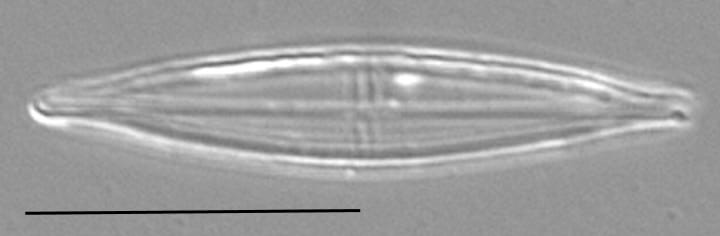 Proschkinia Browderiana Lm3